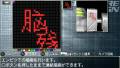 脑残